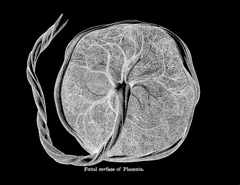 Placenta bandages have far more health benefits than risky placenta pills − a bioengineer explains ​​Science + Tech – The Conversation