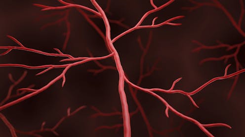 Muscle weakness in cancer survivors may be caused by treatable weakness in blood vessels – new research ​​Health – The Conversation