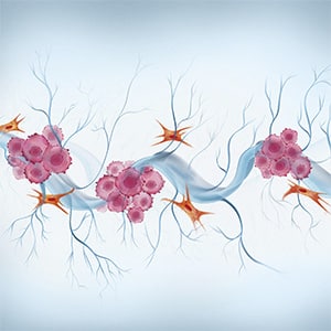 Editors’ Picks, May 2026: Insights Into CAR T Therapy, Neuron-Tumor Crosstalk in Pancreatic Cancer, and More ​​American Association for Cancer Research (AACR)