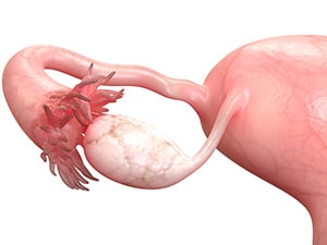 How New Science is Reshaping Ovarian Cancer Treatment and Care ​​American Association for Cancer Research (AACR)