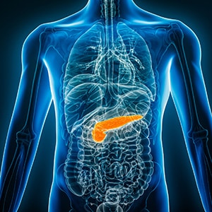 Breaking News: Daraxonrasib Approved for Pancreatic Cancer ​​American Association for Cancer Research (AACR)